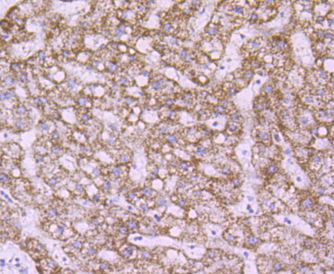Immunohistochemical analysis of paraffin-embedded human liver tissue using anti-Peroxiredoxin 3 antibody. The section was pre-treated using heat mediated antigen retrieval with Tris-EDTA buffer (pH 9.0) for 20 minutes.The tissues were blocked in 1% BSA for 30 minutes at room temperature, washed with ddH2O and PBS, and then probed with the primary antibody (ET1704-92, 1/50) for 30 minutes at room temperature. The detection was performed using an HRP conjugated compact polymer system. DAB was used as the chromogen. Tissues were counterstained with hematoxylin and mounted with DPX.