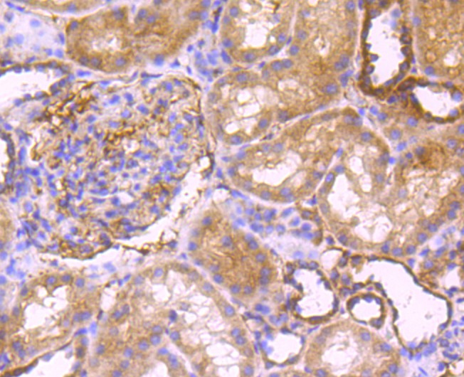 Immunohistochemical analysis of paraffin-embedded human kidney tissue using anti-Peroxiredoxin 3 antibody. The section was pre-treated using heat mediated antigen retrieval with Tris-EDTA buffer (pH 9.0) for 20 minutes.The tissues were blocked in 1% BSA for 30 minutes at room temperature, washed with ddH2O and PBS, and then probed with the primary antibody (ET1704-92, 1/50) for 30 minutes at room temperature. The detection was performed using an HRP conjugated compact polymer system. DAB was used as the chromogen. Tissues were counterstained with hematoxylin and mounted with DPX.