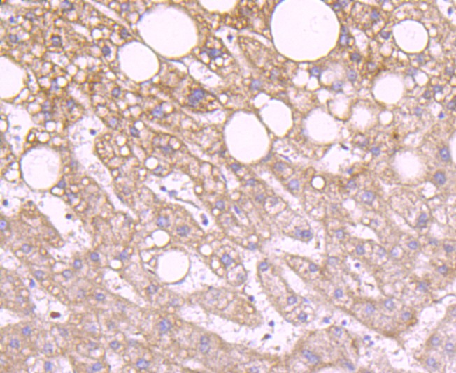 Immunohistochemical analysis of paraffin-embedded human liver tissue using anti-IDH2 antibody. Counter stained with hematoxylin.
