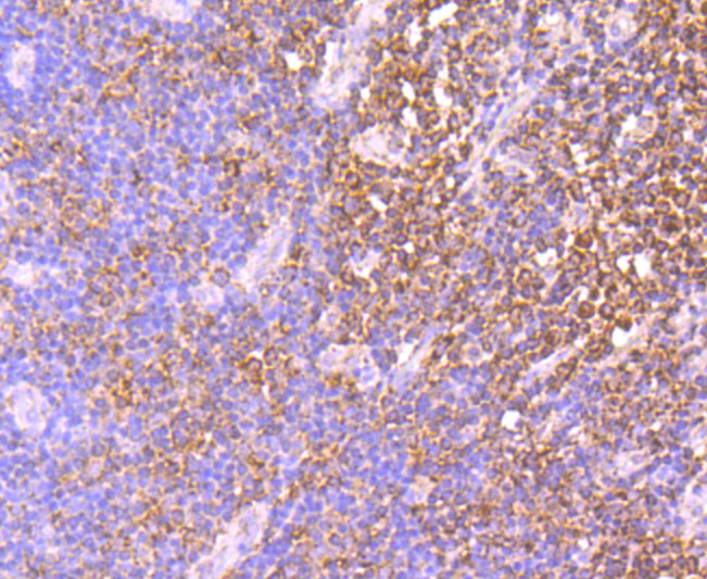 Immunohistochemical analysis of paraffin-embedded human tonsil tissue using anti-IDH2 antibody. Counter stained with hematoxylin.