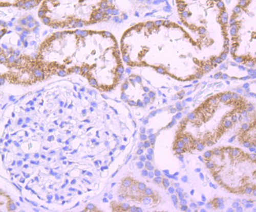 Immunohistochemical analysis of paraffin-embedded human kidney tissue using anti-DOPA Decarboxylase antibody. The section was pre-treated using heat mediated antigen retrieval with Tris-EDTA buffer (pH 9.0) for 20 minutes.The tissues were blocked in 1% BSA for 30 minutes at room temperature, washed with ddH2O and PBS, and then probed with the primary antibody (ET1704-94, 1/50) for 30 minutes at room temperature. The detection was performed using an HRP conjugated compact polymer system. DAB was used as the chromogen. Tissues were counterstained with hematoxylin and mounted with DPX.