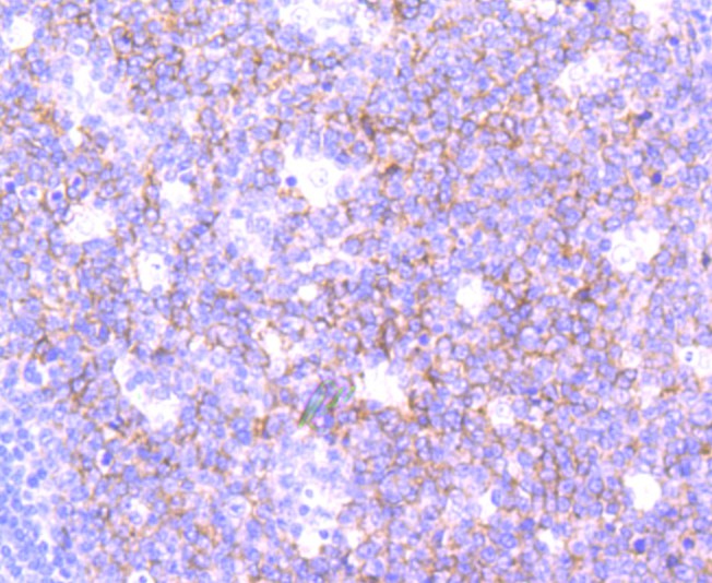 Immunohistochemical analysis of paraffin-embedded human tonsil tissue using anti-SNAP23 antibody. The section was pre-treated using heat mediated antigen retrieval with Tris-EDTA buffer (pH 9.0) for 20 minutes.The tissues were blocked in 1% BSA for 30 minutes at room temperature, washed with ddH2O and PBS, and then probed with the primary antibody (ET1704-95, 1/50) for 30 minutes at room temperature. The detection was performed using an HRP conjugated compact polymer system. DAB was used as the chromogen. Tissues were counterstained with hematoxylin and mounted with DPX.