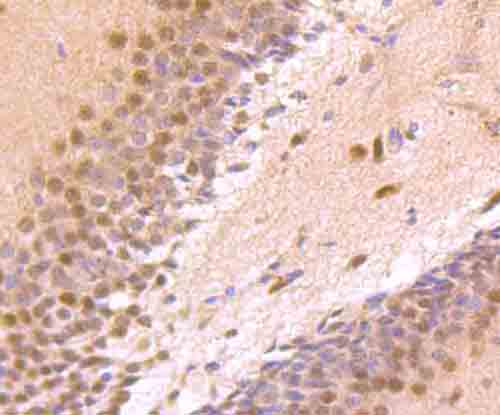 Immunohistochemical analysis of paraffin-embedded rat brain tissue using anti-Zic1 antibody. The section was pre-treated using heat mediated antigen retrieval with Tris-EDTA buffer (pH 9.0) for 20 minutes.The tissues were blocked in 1% BSA for 30 minutes at room temperature, washed with ddH2O and PBS, and then probed with the primary antibody (ET1704-96, 1/50) for 30 minutes at room temperature. The detection was performed using an HRP conjugated compact polymer system. DAB was used as the chromogen. Tissues were counterstained with hematoxylin and mounted with DPX.