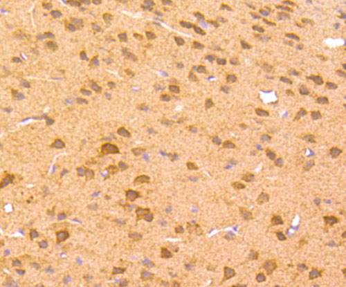 Immunohistochemical analysis of paraffin-embedded mouse brain tissue using anti-Zic1 antibody. The section was pre-treated using heat mediated antigen retrieval with Tris-EDTA buffer (pH 9.0) for 20 minutes.The tissues were blocked in 1% BSA for 30 minutes at room temperature, washed with ddH2O and PBS, and then probed with the primary antibody (ET1704-96, 1/50) for 30 minutes at room temperature. The detection was performed using an HRP conjugated compact polymer system. DAB was used as the chromogen. Tissues were counterstained with hematoxylin and mounted with DPX.