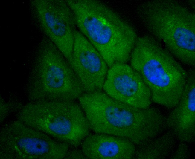 ICC staining CXCR3 in A431 cells (green). The nuclear counter stain is DAPI (blue). Cells were fixed in paraformaldehyde, permeabilised with 0.25% Triton X100/PBS.