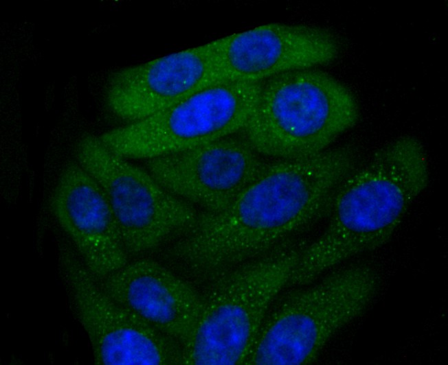 ICC staining CXCR3 in HepG2 cells (green). The nuclear counter stain is DAPI (blue). Cells were fixed in paraformaldehyde, permeabilised with 0.25% Triton X100/PBS.