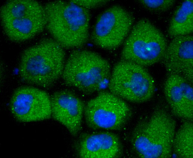 ICC staining CXCR3 in HUVEC cells (green). The nuclear counter stain is DAPI (blue). Cells were fixed in paraformaldehyde, permeabilised with 0.25% Triton X100/PBS.