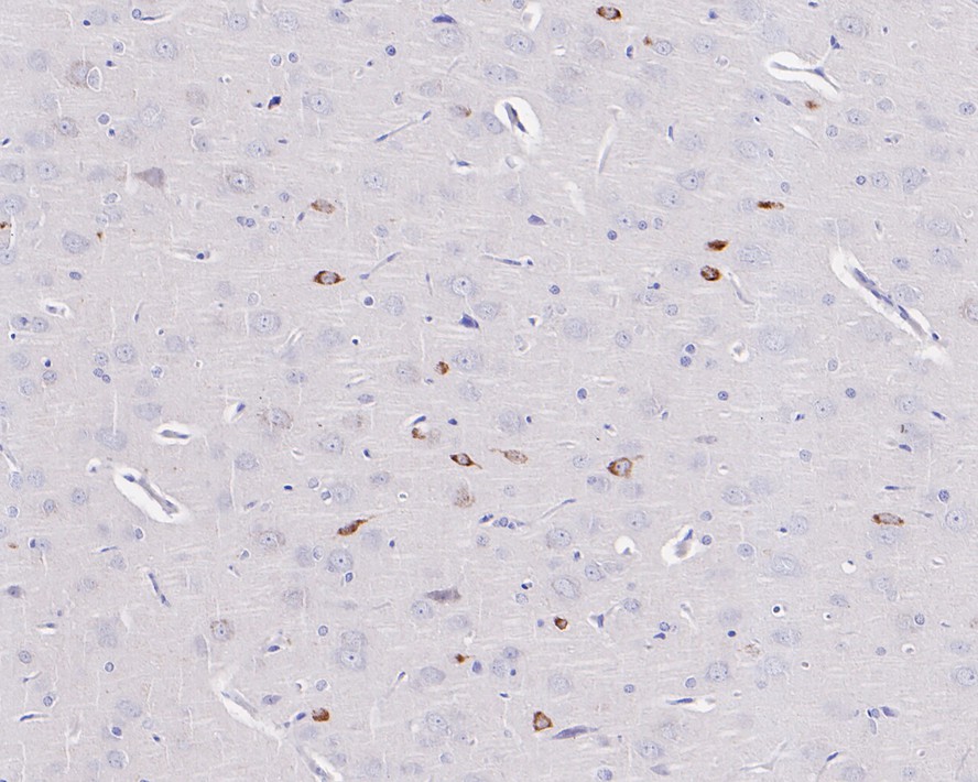Immunohistochemical analysis of paraffin-embedded mouse brain tissue with Rabbit anti-Reelin antibody (ET1704-98) at 1/50 dilution.<br />
<br />
The section was pre-treated using heat mediated antigen retrieval with Tris-EDTA buffer (pH 9.0) for 20 minutes. The tissues were blocked in 1% BSA for 20 minutes at room temperature, washed with ddH2O and PBS, and then probed with the primary antibody (ET1704-98) at 1/50 dilution for 1 hour at room temperature. The detection was performed using an HRP conjugated compact polymer system. DAB was used as the chromogen. Tissues were counterstained with hematoxylin and mounted with DPX.
