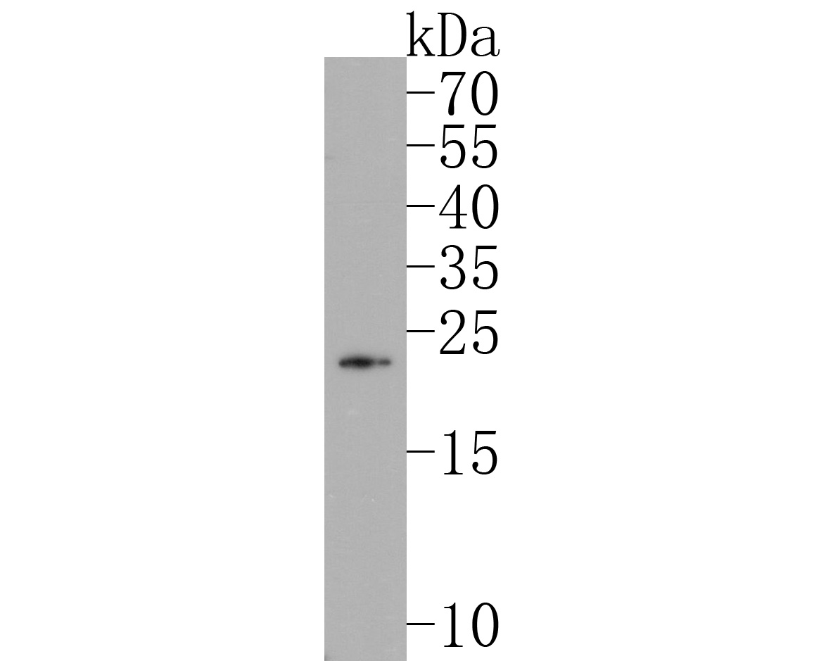Western blot analysis of PLGF on JAR cell lysates. Proteins were transferred to a PVDF membrane and blocked with 5% BSA in PBS for 1 hour at room temperature. The primary antibody (ET1704-99, 1/500) was used in 5% BSA at room temperature for 2 hours. Goat Anti-Rabbit IgG - HRP Secondary Antibody (HA1001) at 1:200,000 dilution was used for 1 hour at room temperature.