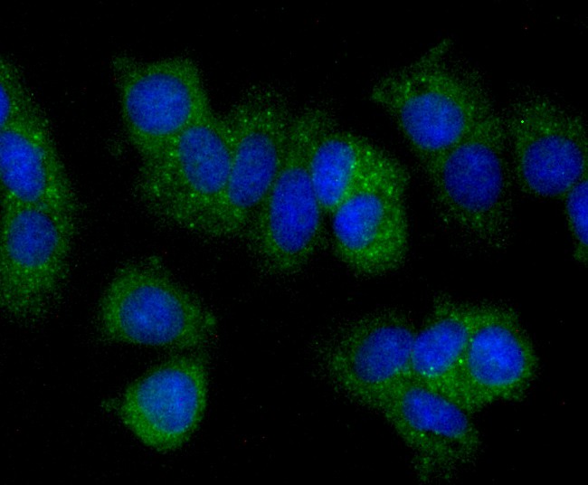 ICC staining of PLGF in MCF-7 cells (green). Formalin fixed cells were permeabilized with 0.1% Triton X-100 in TBS for 10 minutes at room temperature and blocked with 1% Blocker BSA for 15 minutes at room temperature. Cells were probed with the primary antibody (ET1704-99, 1/50) for 1 hour at room temperature, washed with PBS. Alexa Fluor®488 Goat anti-Rabbit IgG was used as the secondary antibody at 1/1,000 dilution. The nuclear counter stain is DAPI (blue).
