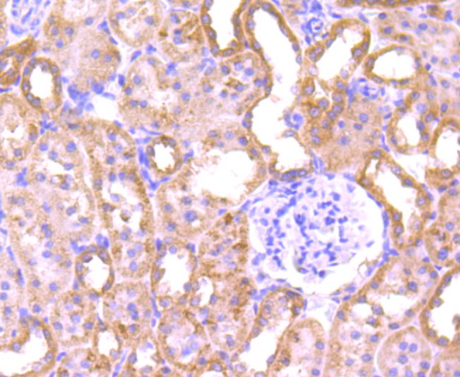 Immunohistochemical analysis of paraffin-embedded rat kidney tissue using anti-PLGF antibody. The section was pre-treated using heat mediated antigen retrieval with Tris-EDTA buffer (pH 8.0-8.4) for 20 minutes.The tissues were blocked in 5% BSA for 30 minutes at room temperature, washed with ddH2O and PBS, and then probed with the primary antibody (ET1704-99, 1/50) for 30 minutes at room temperature. The detection was performed using an HRP conjugated compact polymer system. DAB was used as the chromogen. Tissues were counterstained with hematoxylin and mounted with DPX.