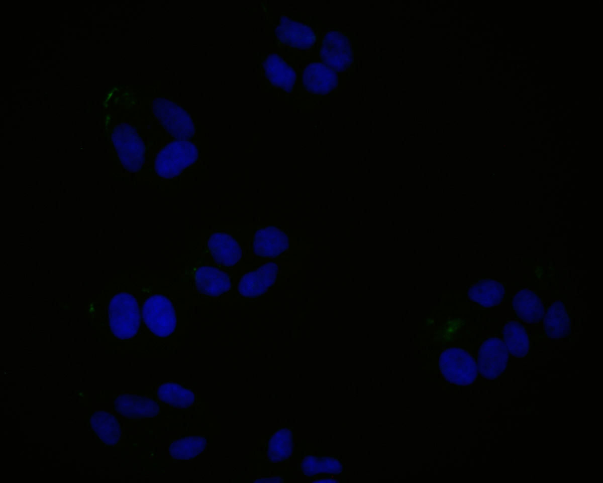 ICC staining of JAK3 in Hela cells (green). Formalin fixed cells were permeabilized with 0.1% Triton X-100 in TBS for 10 minutes at room temperature and blocked with 1% Blocker BSA for 15 minutes at room temperature. Cells were probed with the primary antibody (ET1705-1, 1/50) for 1 hour at room temperature, washed with PBS. Alexa Fluor®488 Goat anti-Rabbit IgG was used as the secondary antibody at 1/1,000 dilution. The nuclear counter stain is DAPI (blue).