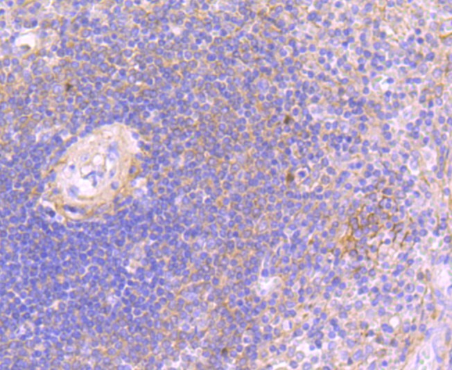 Immunohistochemical analysis of paraffin-embedded human spleen tissue using anti-JAK3 antibody. The section was pre-treated using heat mediated antigen retrieval with Tris-EDTA buffer (pH 8.0-8.4) for 20 minutes.The tissues were blocked in 5% BSA for 30 minutes at room temperature, washed with ddH2O and PBS, and then probed with the primary antibody (ET1705-1, 1/50) for 30 minutes at room temperature. The detection was performed using an HRP conjugated compact polymer system. DAB was used as the chromogen. Tissues were counterstained with hematoxylin and mounted with DPX.