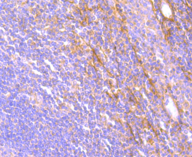 Immunohistochemical analysis of paraffin-embedded human tonsil tissue using anti-JAK3 antibody. The section was pre-treated using heat mediated antigen retrieval with Tris-EDTA buffer (pH 8.0-8.4) for 20 minutes.The tissues were blocked in 5% BSA for 30 minutes at room temperature, washed with ddH2O and PBS, and then probed with the primary antibody (ET1705-1, 1/50) for 30 minutes at room temperature. The detection was performed using an HRP conjugated compact polymer system. DAB was used as the chromogen. Tissues were counterstained with hematoxylin and mounted with DPX.