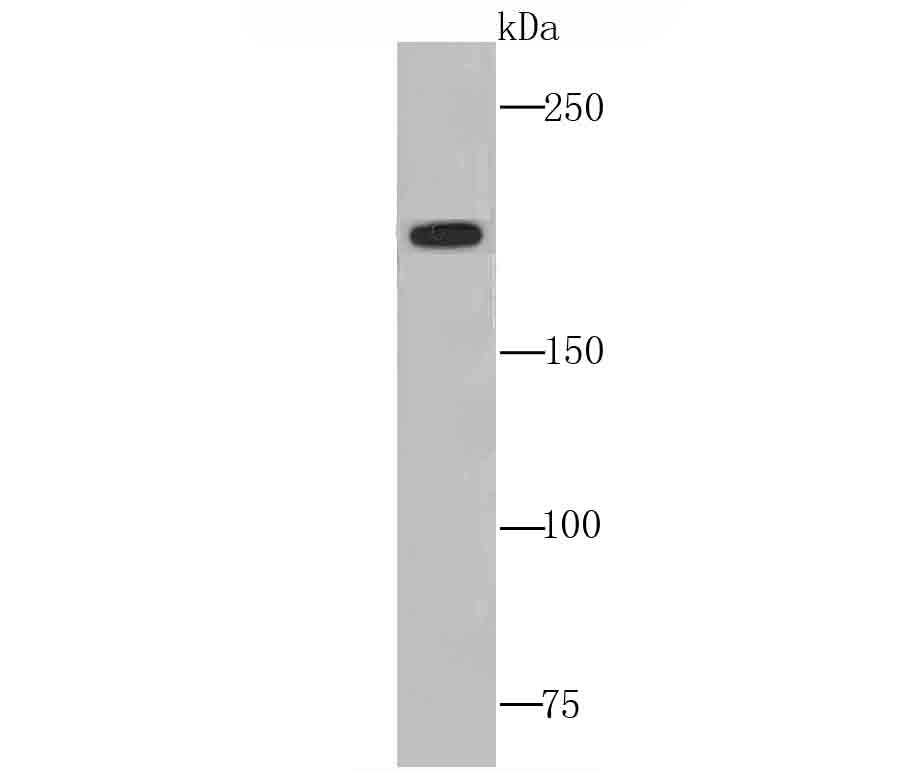 Western blot analysis of C4 on human liver tissue lysates. Proteins were transferred to a PVDF membrane and blocked with 5% BSA in PBS for 1 hour at room temperature. The primary antibody (ET1705-10, 1/500) was used in 5% BSA at room temperature for 2 hours. Goat Anti-Rabbit IgG - HRP Secondary Antibody (HA1001) at 1:200,000 dilution was used for 1 hour at room temperature.