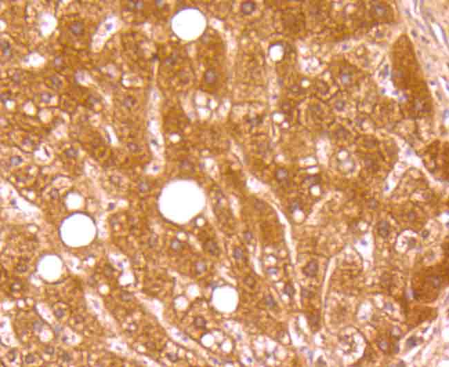 Immunohistochemical analysis of paraffin-embedded human liver tissue using anti-C4 antibody. The section was pre-treated using heat mediated antigen retrieval with Tris-EDTA buffer (pH 9.0) for 20 minutes.The tissues were blocked in 1% BSA for 30 minutes at room temperature, washed with ddH2O and PBS, and then probed with the primary antibody (ET1705-10, 1/50) for 30 minutes at room temperature. The detection was performed using an HRP conjugated compact polymer system. DAB was used as the chromogen. Tissues were counterstained with hematoxylin and mounted with DPX.