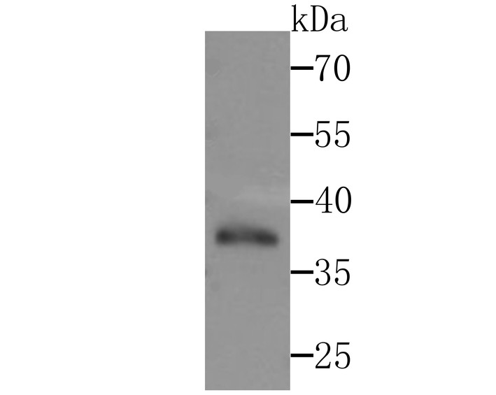 Western blot analysis of DNA Polymerase beta on zebrafish tissue lysates. Proteins were transferred to a PVDF membrane and blocked with 5% BSA in PBS for 1 hour at room temperature. The primary antibody (ET1705-12, 1/500) was used in 5% BSA at room temperature for 2 hours. Goat Anti-Rabbit IgG - HRP Secondary Antibody (HA1001) at 1:200,000 dilution was used for 1 hour at room temperature.