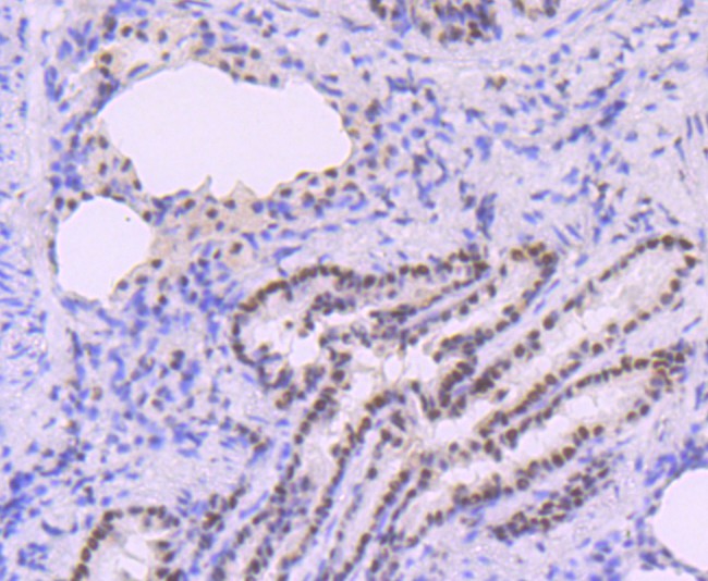 Immunohistochemical analysis of paraffin-embedded rat lung tissue using anti-DNA Polymerase beta antibody. The section was pre-treated using heat mediated antigen retrieval with sodium citrate buffer (pH 6.0) for 20 minutes. The tissues were blocked in 5% BSA for 30 minutes at room temperature, washed with ddH2O and PBS, and then probed with the primary antibody (ET1705-12, 1/50)  for 30 minutes at room temperature. The detection was performed using an HRP conjugated compact polymer system. DAB was used as the chromogen. Tissues were counterstained with hematoxylin and mounted with DPX.