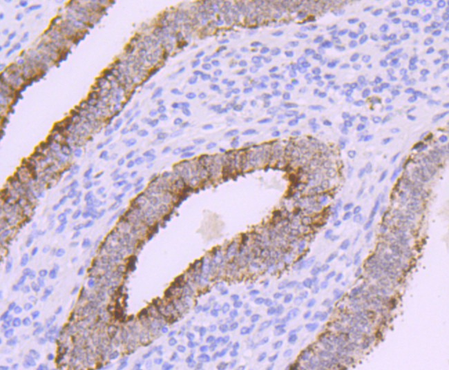 Immunohistochemical analysis of paraffin-embedded human uterus tissue using anti-DNA Polymerase beta antibody. The section was pre-treated using heat mediated antigen retrieval with sodium citrate buffer (pH 6.0) for 20 minutes. The tissues were blocked in 5% BSA for 30 minutes at room temperature, washed with ddH2O and PBS, and then probed with the primary antibody (ET1705-12, 1/50)  for 30 minutes at room temperature. The detection was performed using an HRP conjugated compact polymer system. DAB was used as the chromogen. Tissues were counterstained with hematoxylin and mounted with DPX.
