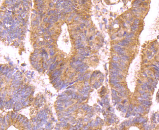 Immunohistochemical analysis of paraffin-embedded human colon tissue using anti-MUC4 antibody. The section was pre-treated using heat mediated antigen retrieval with Tris-EDTA buffer (pH 9.0) for 20 minutes.The tissues were blocked in 1% BSA for 30 minutes at room temperature, washed with ddH2O and PBS, and then probed with the primary antibody (ET1705-13, 1/50) for 30 minutes at room temperature. The detection was performed using an HRP conjugated compact polymer system. DAB was used as the chromogen. Tissues were counterstained with hematoxylin and mounted with DPX.