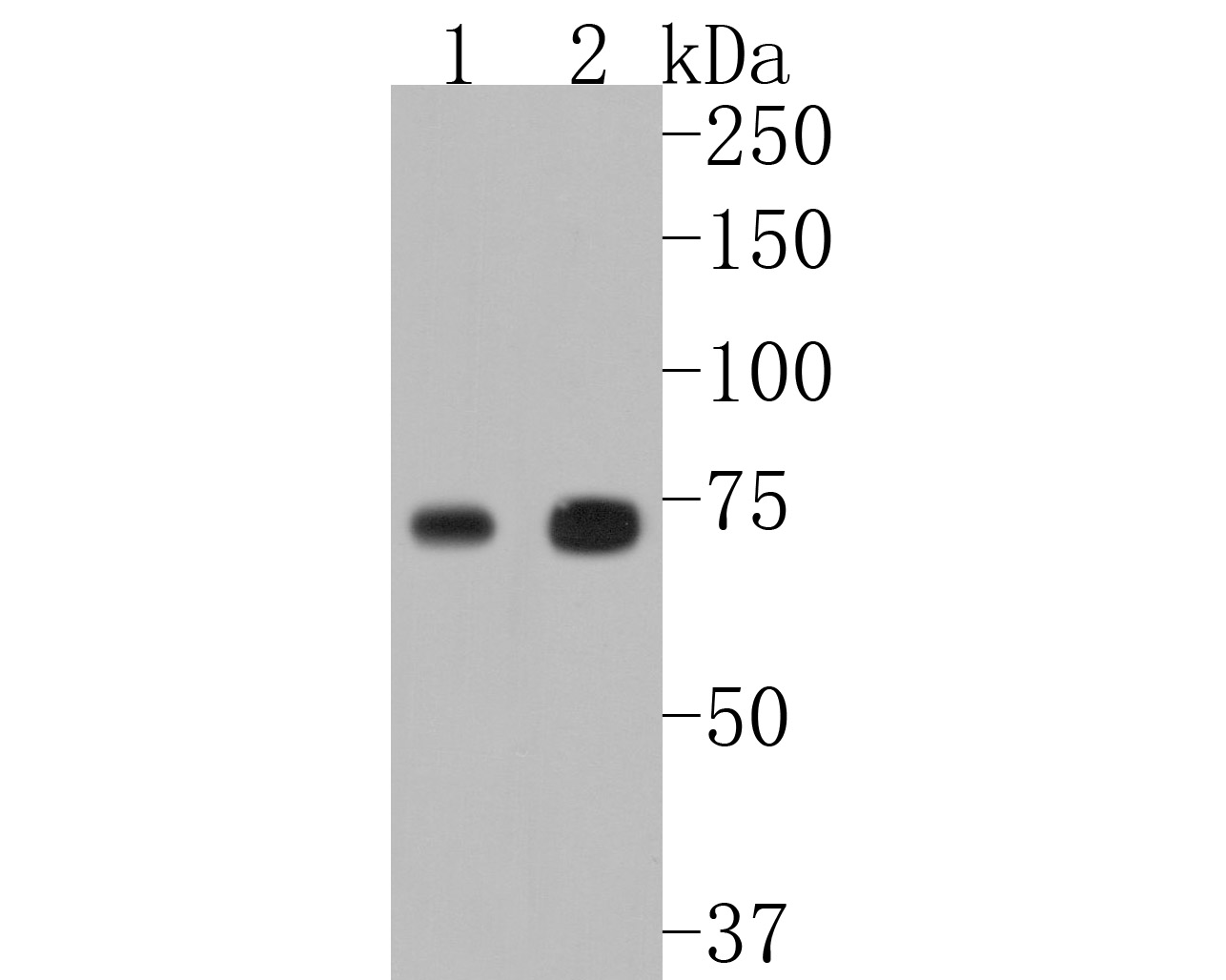 ICC staining of TAK1 in A431 cells (green). Formalin fixed cells were permeabilized with 0.1% Triton X-100 in TBS for 10 minutes at room temperature and blocked with 1% Blocker BSA for 15 minutes at room temperature. Cells were probed with the primary antibody (ET1705-14, 1/50) for 1 hour at room temperature, washed with PBS. Alexa Fluor®488 Goat anti-Rabbit IgG was used as the secondary antibody at 1/1,000 dilution. The nuclear counter stain is DAPI (blue).