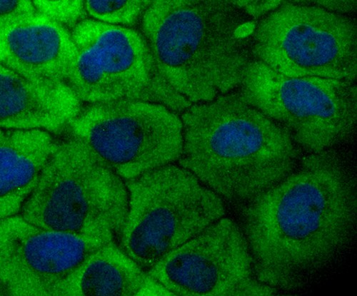 ICC staining of TAK1 in N2A cells (green). Formalin fixed cells were permeabilized with 0.1% Triton X-100 in TBS for 10 minutes at room temperature and blocked with 1% Blocker BSA for 15 minutes at room temperature. Cells were probed with the primary antibody (ET1705-14, 1/50) for 1 hour at room temperature, washed with PBS. Alexa Fluor®488 Goat anti-Rabbit IgG was used as the secondary antibody at 1/1,000 dilution. The nuclear counter stain is DAPI (blue).