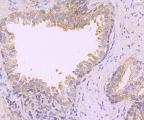 Immunohistochemical analysis of paraffin-embedded mouse stomach tissue using anti-TAK1 antibody. The section was pre-treated using heat mediated antigen retrieval with Tris-EDTA buffer (pH 8.0-8.4) for 20 minutes.The tissues were blocked in 5% BSA for 30 minutes at room temperature, washed with ddH2O and PBS, and then probed with the primary antibody (ET1705-14, 1/50) for 30 minutes at room temperature. The detection was performed using an HRP conjugated compact polymer system. DAB was used as the chromogen. Tissues were counterstained with hematoxylin and mounted with DPX.