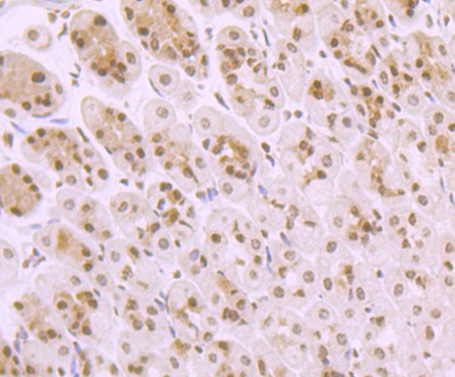 Immunohistochemical analysis of paraffin-embedded human placenta tissue using anti-TAK1 antibody. The section was pre-treated using heat mediated antigen retrieval with Tris-EDTA buffer (pH 8.0-8.4) for 20 minutes.The tissues were blocked in 5% BSA for 30 minutes at room temperature, washed with ddH2O and PBS, and then probed with the primary antibody (ET1705-14, 1/50) for 30 minutes at room temperature. The detection was performed using an HRP conjugated compact polymer system. DAB was used as the chromogen. Tissues were counterstained with hematoxylin and mounted with DPX.