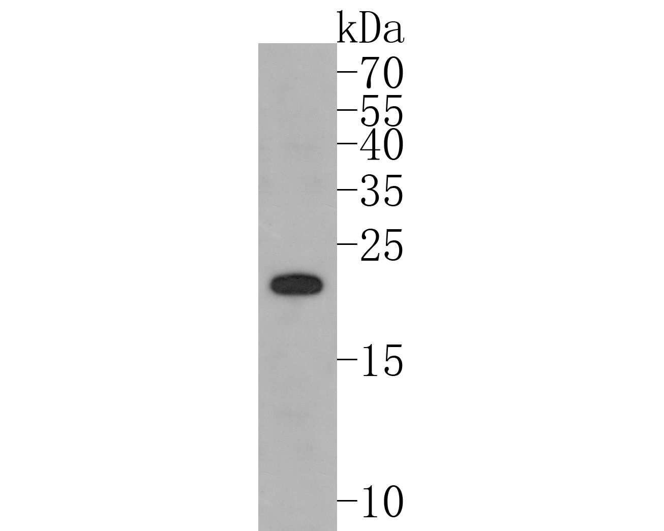 Western blot analysis of PMP22 on PC-12 cell lysates. Proteins were transferred to a PVDF membrane and blocked with 5% BSA in PBS for 1 hour at room temperature. The primary antibody (ET1705-15, 1/500) was used in 5% BSA at room temperature for 2 hours. Goat Anti-Rabbit IgG - HRP Secondary Antibody (HA1001) at 1:5,000 dilution was used for 1 hour at room temperature.