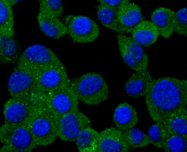 ICC staining of PMP22 in N2A cells (green). Formalin fixed cells were permeabilized with 0.1% Triton X-100 in TBS for 10 minutes at room temperature and blocked with 1% Blocker BSA for 15 minutes at room temperature. Cells were probed with the primary antibody (ET1705-15, 1/50) for 1 hour at room temperature, washed with PBS. Alexa Fluor®488 Goat anti-Rabbit IgG was used as the secondary antibody at 1/1,000 dilution. The nuclear counter stain is DAPI (blue).