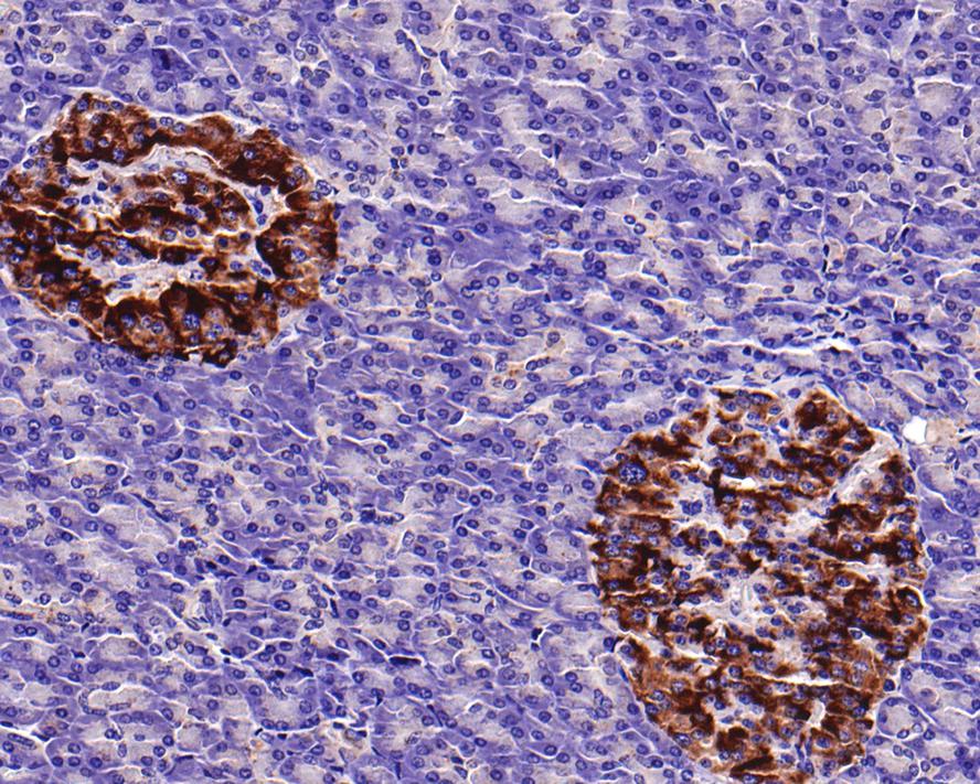 Immunohistochemical analysis of paraffin-embedded human pancreas tissue with Rabbit anti-PMP22 antibody (ET1705-15) at 1/500 dilution.<br />
<br />
The section was pre-treated using heat mediated antigen retrieval with Tris-EDTA buffer (pH 9.0) for 20 minutes. The tissues were blocked in 1% BSA for 20 minutes at room temperature, washed with ddH2O and PBS, and then probed with the primary antibody (ET1705-15) at 1/500 dilution for 1 hour at room temperature. The detection was performed using an HRP conjugated compact polymer system. DAB was used as the chromogen. Tissues were counterstained with hematoxylin and mounted with DPX.