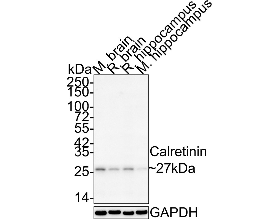 Western blot analysis of Calretinin on different lysates with Rabbit anti-Calretinin antibody (ET1705-19) at 1/2,000 dilution.<br />
<br />
Lane 1: Mouse brain tissue lysate<br />
Lane 2: Rat brain tissue lysate<br />
Lane 3: Mouse hippocampus tissue lysate<br />
Lane 4: Rat hippocampus tissue lysate<br />
<br />
Lysates/proteins at 20 µg/Lane.<br />
<br />
Predicted band size: 32 kDa<br />
Observed band size: 27 kDa<br />
<br />
Exposure time: 7 minutes;<br />
<br />
4-20% SDS-PAGE gel.<br />
<br />
Proteins were transferred to a PVDF membrane and blocked with 5% NFDM/TBST for 1 hour at room temperature. The primary antibody (ET1705-19) at 1/2,000 dilution was used in 5% NFDM/TBST at 4℃ overnight. Goat Anti-Rabbit IgG - HRP Secondary Antibody (HA1001) at 1:50,000 dilution was used for 1 hour at room temperature.