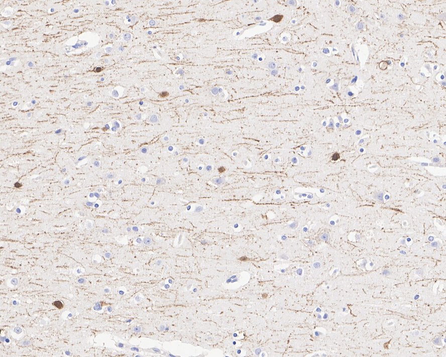Immunohistochemical analysis of paraffin-embedded human brain tissue with Rabbit anti-Calretinin antibody (ET1705-19) at 1/5,000 dilution.<br />
<br />
The section was pre-treated using heat mediated antigen retrieval with Tris-EDTA buffer (pH 9.0) for 20 minutes. The tissues were blocked in 1% BSA for 20 minutes at room temperature, washed with ddH2O and PBS, and then probed with the primary antibody (ET1705-19) at 1/5,000 dilution for 1 hour at room temperature. The detection was performed using an HRP conjugated compact polymer system. DAB was used as the chromogen. Tissues were counterstained with hematoxylin and mounted with DPX.
