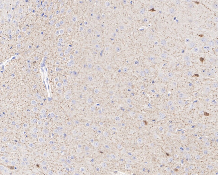Immunohistochemical analysis of paraffin-embedded mouse brain tissue with Rabbit anti-Calretinin antibody (ET1705-19) at 1/5,000 dilution.<br />
<br />
The section was pre-treated using heat mediated antigen retrieval with Tris-EDTA buffer (pH 9.0) for 20 minutes. The tissues were blocked in 1% BSA for 20 minutes at room temperature, washed with ddH2O and PBS, and then probed with the primary antibody (ET1705-19) at 1/5,000 dilution for 1 hour at room temperature. The detection was performed using an HRP conjugated compact polymer system. DAB was used as the chromogen. Tissues were counterstained with hematoxylin and mounted with DPX.