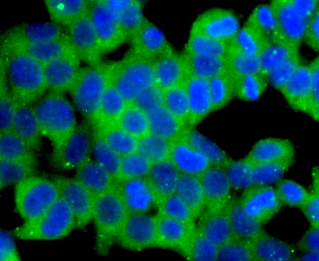 ICC staining of Dynamin 2 in 293T cells (green). Formalin fixed cells were permeabilized with 0.1% Triton X-100 in TBS for 10 minutes at room temperature and blocked with 10% negative goat serum for 15 minutes at room temperature. Cells were probed with the primary antibody (ET1705-2, 1/50) for 1 hour at room temperature, washed with PBS. Alexa Fluor®488 conjugate-Goat anti-Rabbit IgG was used as the secondary antibody at 1/1,000 dilution. The nuclear counter stain is DAPI (blue).
