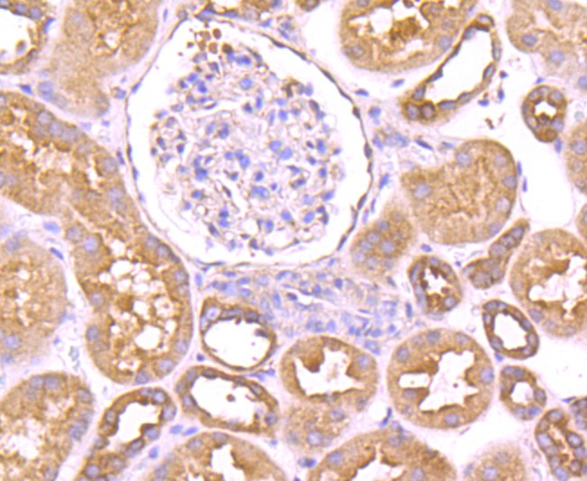 Immunohistochemical analysis of paraffin-embedded human kidney tissue using anti-Dynamin 2 antibody. The section was pre-treated using heat mediated antigen retrieval with Tris-EDTA buffer (pH 9.0) for 20 minutes.The tissues were blocked in 1% BSA for 30 minutes at room temperature, washed with ddH2O and PBS, and then probed with the primary antibody (ET1705-2, 1/50) for 30 minutes at room temperature. The detection was performed using an HRP conjugated compact polymer system. DAB was used as the chromogen. Tissues were counterstained with hematoxylin and mounted with DPX.