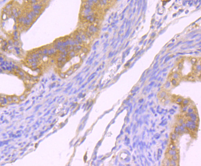 Immunohistochemical analysis of paraffin-embedded mouse fallopian tissue using anti-Dynamin 2 antibody. The section was pre-treated using heat mediated antigen retrieval with Tris-EDTA buffer (pH 9.0) for 20 minutes.The tissues were blocked in 1% BSA for 30 minutes at room temperature, washed with ddH2O and PBS, and then probed with the primary antibody (ET1705-2, 1/50) for 30 minutes at room temperature. The detection was performed using an HRP conjugated compact polymer system. DAB was used as the chromogen. Tissues were counterstained with hematoxylin and mounted with DPX.