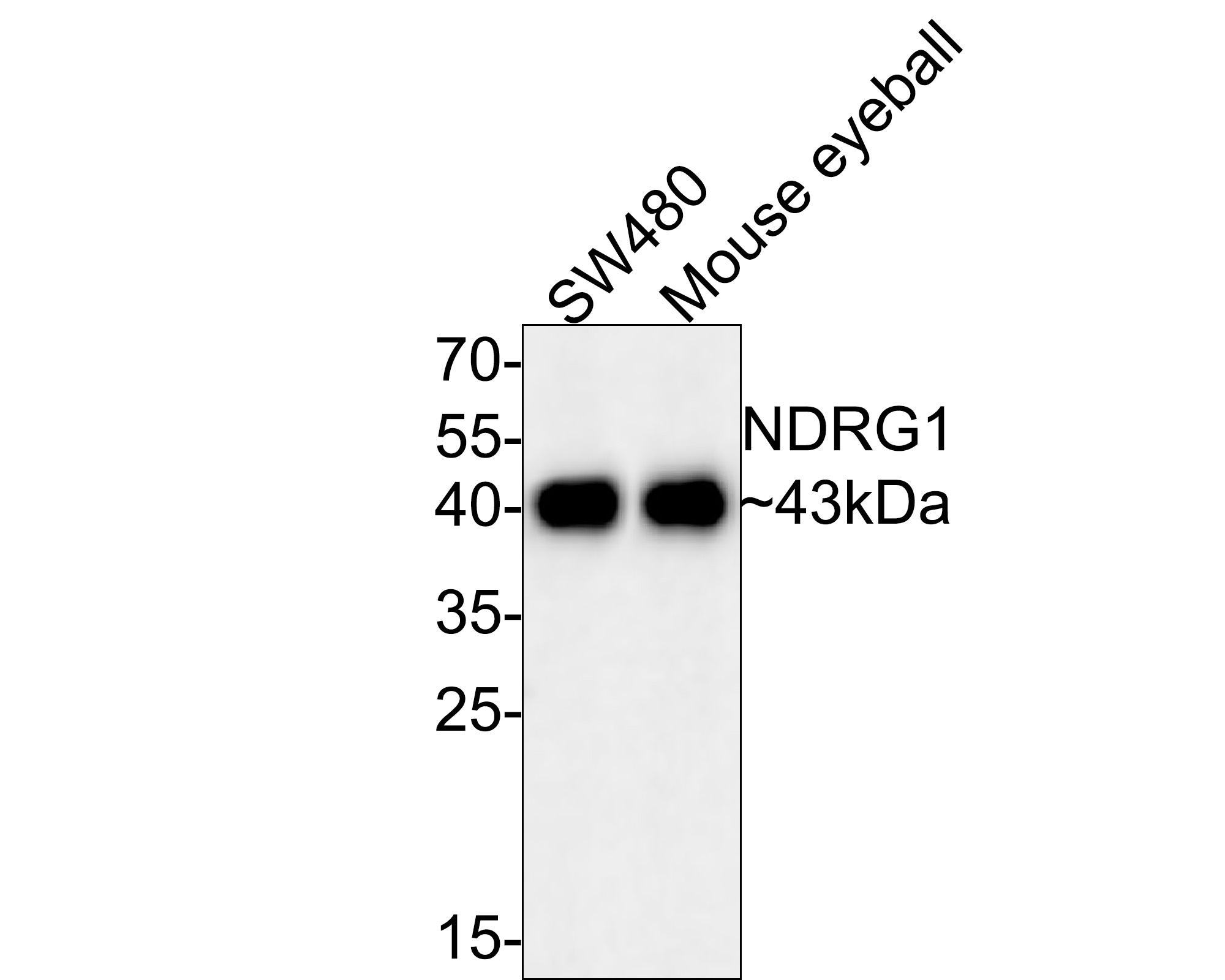 Western blot analysis of NDRG1 on different lysates with Rabbit anti-NDRG1 antibody (ET1705-20) at 1/500 dilution.<br />
<br />
Lane 1: SW480 cell lysate (10 µg/Lane)<br />
Lane 2: Mouse eyeball tissue lysate (20 µg/Lane)<br />
<br />
Predicted band size: 43 kDa<br />
Observed band size: 43 kDa<br />
<br />
Exposure time: 33 seconds;<br />
<br />
12% SDS-PAGE gel.<br />
<br />
Proteins were transferred to a PVDF membrane and blocked with 5% NFDM/TBST for 1 hour at room temperature. The primary antibody (ET1705-20) at 1/500 dilution was used in 5% NFDM/TBST at room temperature for 2 hours. Goat Anti-Rabbit IgG - HRP Secondary Antibody (HA1001) at 1:300,000 dilution was used for 1 hour at room temperature.