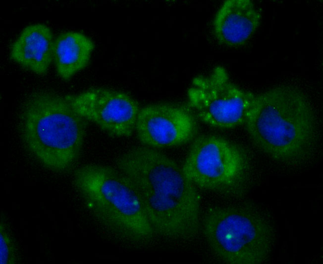 ICC staining of NDRG1 in A431 cells (green). Formalin fixed cells were permeabilized with 0.1% Triton X-100 in TBS for 10 minutes at room temperature and blocked with 1% Blocker BSA for 15 minutes at room temperature. Cells were probed with the primary antibody (ET1705-20, 1/50) for 1 hour at room temperature, washed with PBS. Alexa Fluor®488 Goat anti-Rabbit IgG was used as the secondary antibody at 1/1,000 dilution. The nuclear counter stain is DAPI (blue).