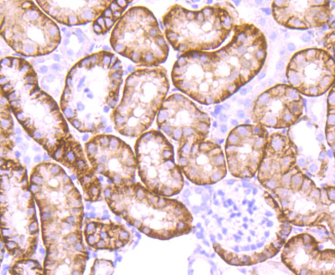Immunohistochemical analysis of paraffin-embedded mouse kidney tissue using anti-NDRG1 antibody. The section was pre-treated using heat mediated antigen retrieval with Tris-EDTA buffer (pH 8.0-8.4) for 20 minutes.The tissues were blocked in 5% BSA for 30 minutes at room temperature, washed with ddH2O and PBS, and then probed with the primary antibody (ET1705-20, 1/50) for 30 minutes at room temperature. The detection was performed using an HRP conjugated compact polymer system. DAB was used as the chromogen. Tissues were counterstained with hematoxylin and mounted with DPX.