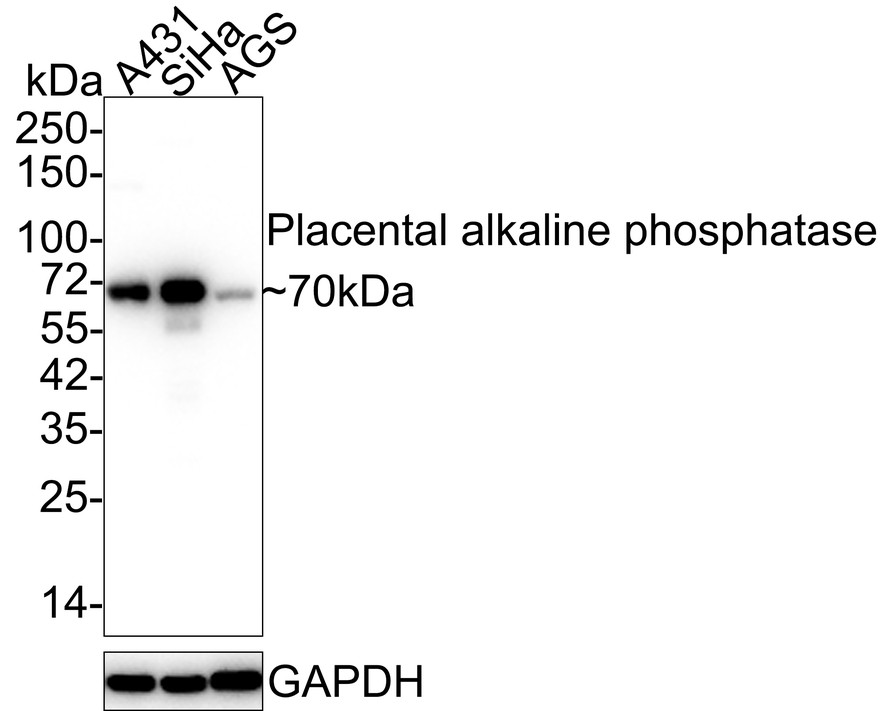 Western blot analysis of Placental alkaline phosphatase on human placenta tissue lysates with Rabbit anti-Placental alkaline phosphatase antibody (ET1705-21) at 1/500 dilution.<br />
<br />
Lysates/proteins at 20 µg/Lane.<br />
<br />
Predicted band size: 58 kDa<br />
Observed band size: 70 kDa<br />
<br />
Exposure time: 30 seconds;<br />
<br />
8% SDS-PAGE gel.<br />
<br />
Proteins were transferred to a PVDF membrane and blocked with 5% NFDM/TBST for 1 hour at room temperature. The primary antibody (ET1705-21) at 1/500 dilution was used in 5% NFDM/TBST at room temperature for 2 hours. Goat Anti-Rabbit IgG - HRP Secondary Antibody (HA1001) at 1:300,000 dilution was used for 1 hour at room temperature.