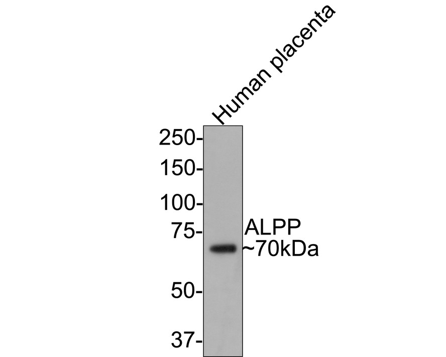 Immunocytochemistry analysis of Hela cells labeling Placental alkaline phosphatase with Rabbit anti-Placental alkaline phosphatase antibody (ET1705-21) at 1/50 dilution.<br />
<br />
Cells were fixed in 4% paraformaldehyde for 10 minutes at 37 ℃, permeabilized with 0.05% Triton X-100 in PBS for 20 minutes, and then blocked with 2% negative goat serum for 30 minutes at room temperature. Cells were then incubated with Rabbit anti-Placental alkaline phosphatase antibody (ET1705-21) at 1/50 dilution in 2% negative goat serum overnight at 4 ℃. Goat Anti-Rabbit IgG H&L (iFluor™ 488, HA1121) was used as the secondary antibody at 1/1,000 dilution. PBS instead of the primary antibody was used as the secondary antibody only control. Nuclear DNA was labelled in blue with DAPI.