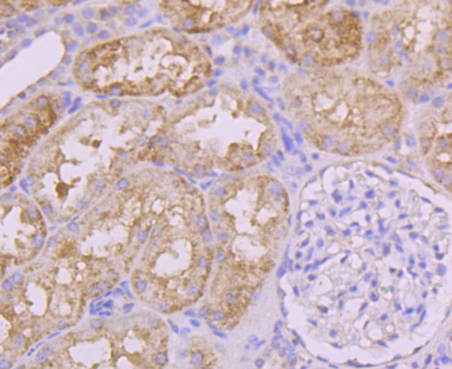 Immunohistochemical analysis of paraffin-embedded human kidney tissue using anti-Insulin Receptor R antibody. The section was pre-treated using heat mediated antigen retrieval with Tris-EDTA buffer (pH 9.0) for 20 minutes.The tissues were blocked in 1% BSA for 30 minutes at room temperature, washed with ddH2O and PBS, and then probed with the primary antibody (ET1705-22, 1/50) for 30 minutes at room temperature. The detection was performed using an HRP conjugated compact polymer system. DAB was used as the chromogen. Tissues were counterstained with hematoxylin and mounted with DPX.