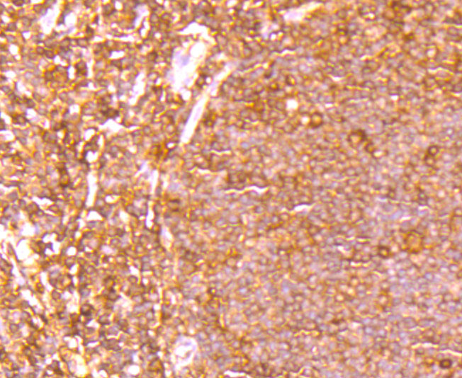 Immunohistochemical analysis of paraffin-embedded human tonsil tissue using anti-ETS1 antibody. The section was pre-treated using heat mediated antigen retrieval with Tris-EDTA buffer (pH 8.0-8.4) for 20 minutes.The tissues were blocked in 5% BSA for 30 minutes at room temperature, washed with ddH2O and PBS, and then probed with the primary antibody (ET1705-23, 1/50) for 30 minutes at room temperature. The detection was performed using an HRP conjugated compact polymer system. DAB was used as the chromogen. Tissues were counterstained with hematoxylin and mounted with DPX.