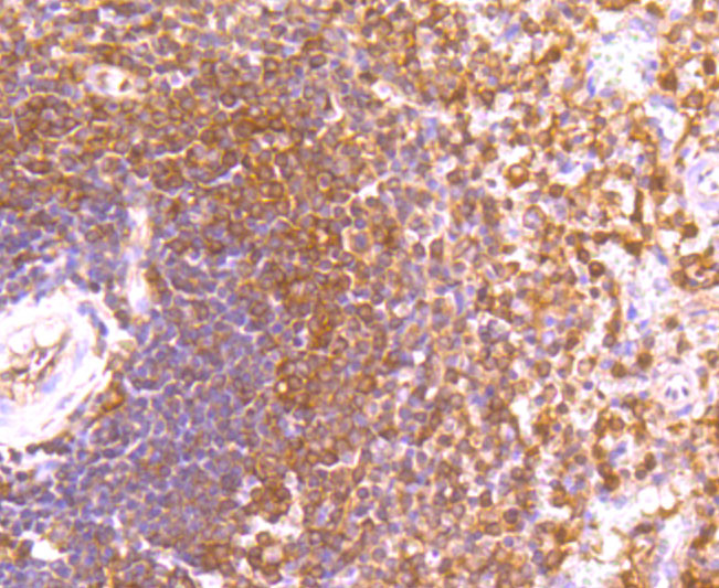 Immunohistochemical analysis of paraffin-embedded human spleen tissue using anti-ETS1 antibody. The section was pre-treated using heat mediated antigen retrieval with Tris-EDTA buffer (pH 8.0-8.4) for 20 minutes.The tissues were blocked in 5% BSA for 30 minutes at room temperature, washed with ddH2O and PBS, and then probed with the primary antibody (ET1705-23, 1/50) for 30 minutes at room temperature. The detection was performed using an HRP conjugated compact polymer system. DAB was used as the chromogen. Tissues were counterstained with hematoxylin and mounted with DPX.