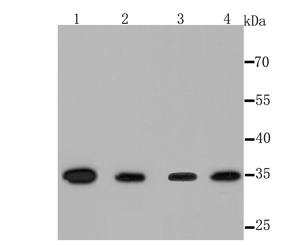Western blot analysis of Thymidylate Synthase on different lysate using anti-Thymidylate Synthase antibody at 1/1,000 dilution.<br />
  Positive control:<br />
  Lane 1: Hela cell lysate<br />
  Lane 2: Jurkat cell lysate<br />
  Lane 3: Raji cell lysate<br />
  Lane 4: Mouse thymus tissue lysate