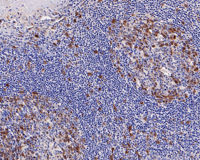 Immunohistochemical analysis of paraffin-embedded human tonsil tissue with Rabbit anti-Thymidylate Synthase antibody (ET1705-24) at 1/200 dilution.<br />
<br />
The section was pre-treated using heat mediated antigen retrieval with Tris-EDTA buffer (pH 9.0) for 20 minutes. The tissues were blocked in 1% BSA for 20 minutes at room temperature, washed with ddH2O and PBS, and then probed with the primary antibody (ET1705-24) at 1/200 dilution for 1 hour at room temperature. The detection was performed using an HRP conjugated compact polymer system. DAB was used as the chromogen. Tissues were counterstained with hematoxylin and mounted with DPX.