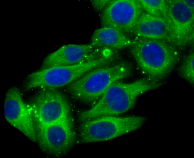 ICC staining of Cytochrome P450 2D6 in HepG2 cells (green). Formalin fixed cells were permeabilized with 0.1% Triton X-100 in TBS for 10 minutes at room temperature and blocked with 10% negative goat serum for 15 minutes at room temperature. Cells were probed with the primary antibody (ET1705-28, 1/50) for 1 hour at room temperature, washed with PBS. Alexa Fluor®488 conjugate-Goat anti-Rabbit IgG was used as the secondary antibody at 1/1,000 dilution. The nuclear counter stain is DAPI (blue).