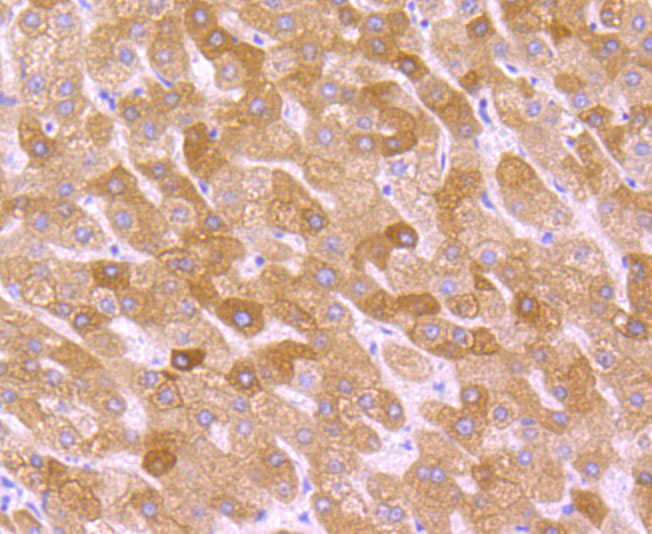 Immunohistochemical analysis of paraffin-embedded human liver tissue using anti-Cytochrome P450 2D6 antibody. The section was pre-treated using heat mediated antigen retrieval with Tris-EDTA buffer (pH 9.0) for 20 minutes.The tissues were blocked in 1% BSA for 30 minutes at room temperature, washed with ddH2O and PBS, and then probed with the primary antibody (ET1705-28, 1/50) for 30 minutes at room temperature. The detection was performed using an HRP conjugated compact polymer system. DAB was used as the chromogen. Tissues were counterstained with hematoxylin and mounted with DPX.