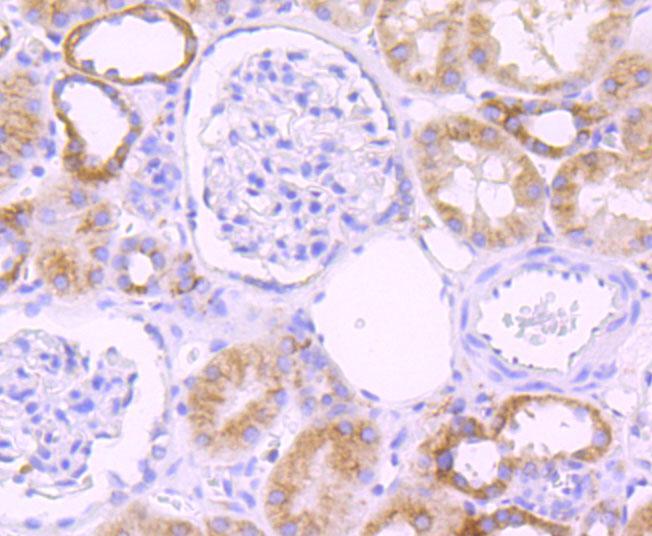 Immunohistochemical analysis of paraffin-embedded human kidney tissue using anti-Cytochrome P450 2D6 antibody. The section was pre-treated using heat mediated antigen retrieval with Tris-EDTA buffer (pH 9.0) for 20 minutes.The tissues were blocked in 1% BSA for 30 minutes at room temperature, washed with ddH2O and PBS, and then probed with the primary antibody (ET1705-28, 1/50) for 30 minutes at room temperature. The detection was performed using an HRP conjugated compact polymer system. DAB was used as the chromogen. Tissues were counterstained with hematoxylin and mounted with DPX.